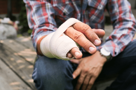 Man with a cast on his hand